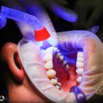 dentist, facet, uv light-1864921.jpg
